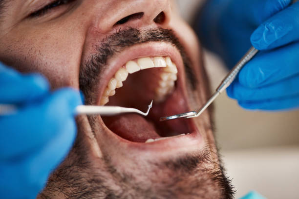 Best Oral Cancer Screening  in Ller, WA